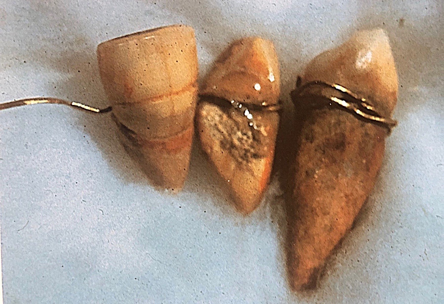 Restorative false teeth by the Etruscans